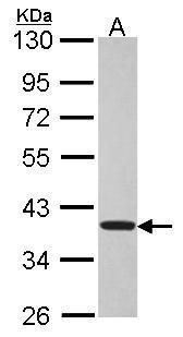 TSSC1 Rabbit Polyclonal Antibody