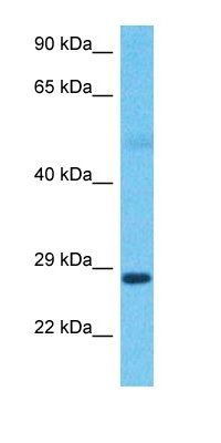 TSSC4 antibody