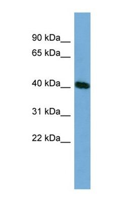 TSSK2 antibody