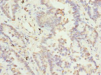 TSSK3 Antibody
