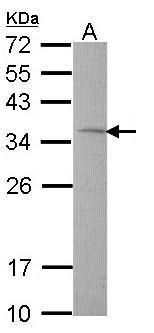 TST Rabbit Polyclonal Antibody
