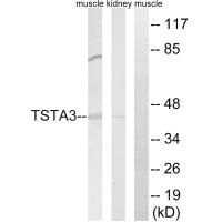 TSTA3 antibody