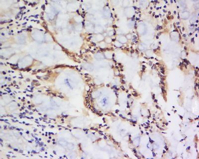 Tsukushin Rabbit Polyclonal Antibody