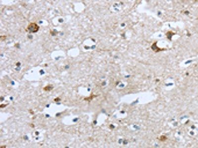 TTBK1 Antibody