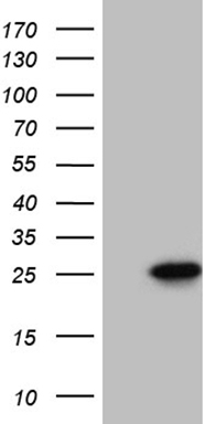 TTC14 antibody
