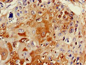 TTC19 Antibody