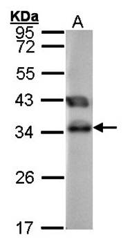 TTC1 antibody