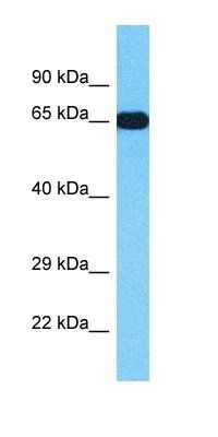 TTC22 antibody
