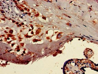 TTC27 Antibody