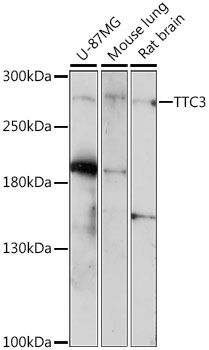 TTC3 antibody
