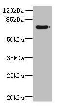 TTC30A antibody