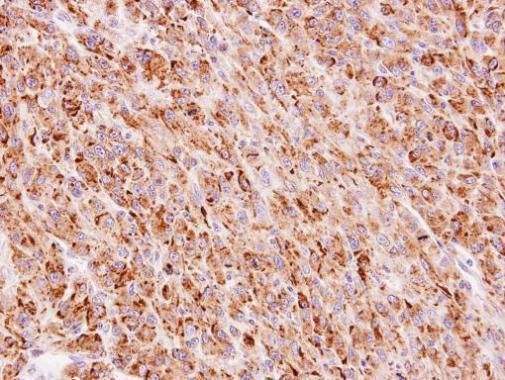 TTC30A antibody [C1C3]