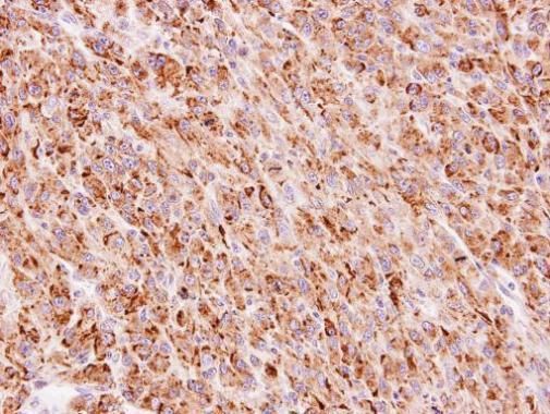 TTC30A antibody