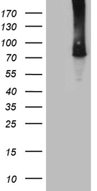 TTC30B antibody