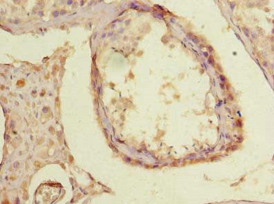TTC30B Antibody
