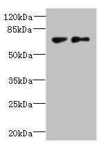 TTC30B antibody