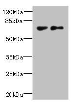 TTC30B Antibody