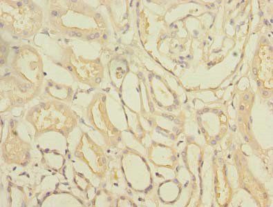 TTC33 Antibody