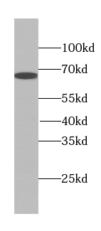 TTC39A antibody