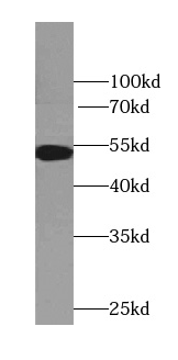 TTC7B antibody