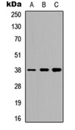 TTF1 antibody
