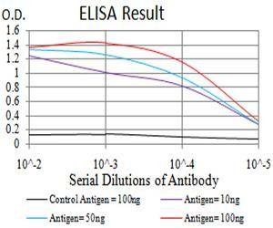 TTF1 Antibody