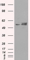 TTF1 Antibody