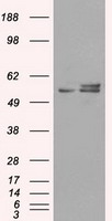 TTF1 (NKX2-1) antibody