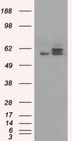 TTF1 (NKX2-1) antibody