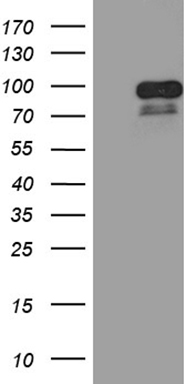 TTF1 Antibody