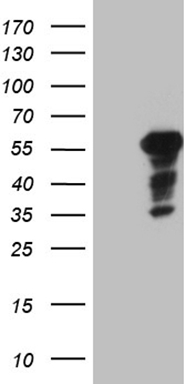 TTF1 Antibody