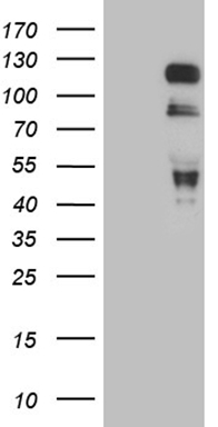 TTF1 (NKX2-1) antibody
