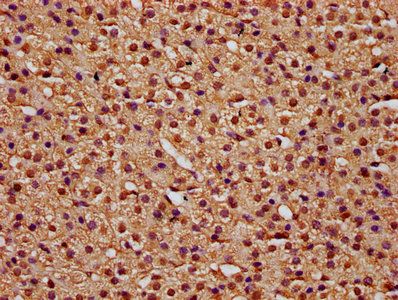 TTI2 Antibody