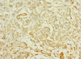 TTLL2 Antibody