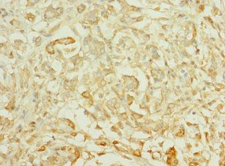 TTLL2 antibody