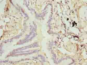 TTLL6 antibody