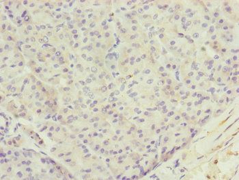 TTLL7 Antibody
