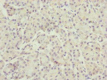 TTLL7 Antibody