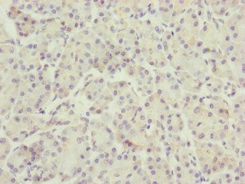 TTLL7 antibody