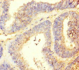 TTLL9 Antibody