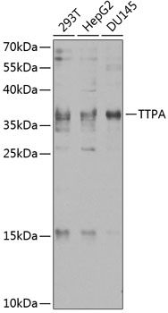 TTPA antibody