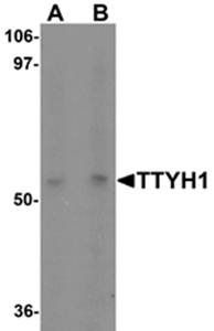TTYH1 Antibody