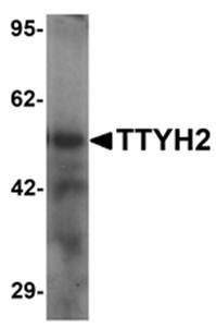 TTYH2 Antibody