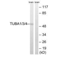 TUBA1A/TUBA1B/TUBA1C/TUBA3C/TUBA3E/TUBA4A (Ab-272) Antibody