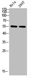 TUBA1A/TUBA1B/TUBA1C/TUBA3C/TUBA8/TUBA4A Antibody