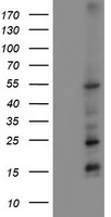 TUBA3E Antibody