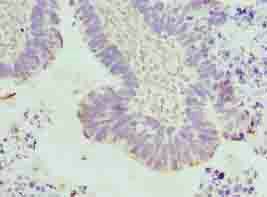 TUBA3E Antibody