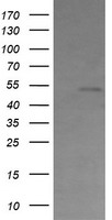 TUBAL3 Antibody