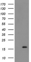 TUBAL3 antibody