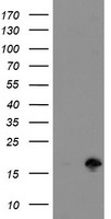 TUBAL3 antibody